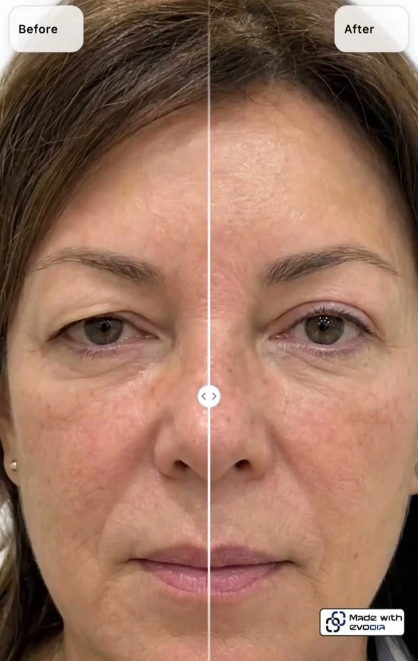 Before-and-after patient photo comparison in the evooia app (Slider)
