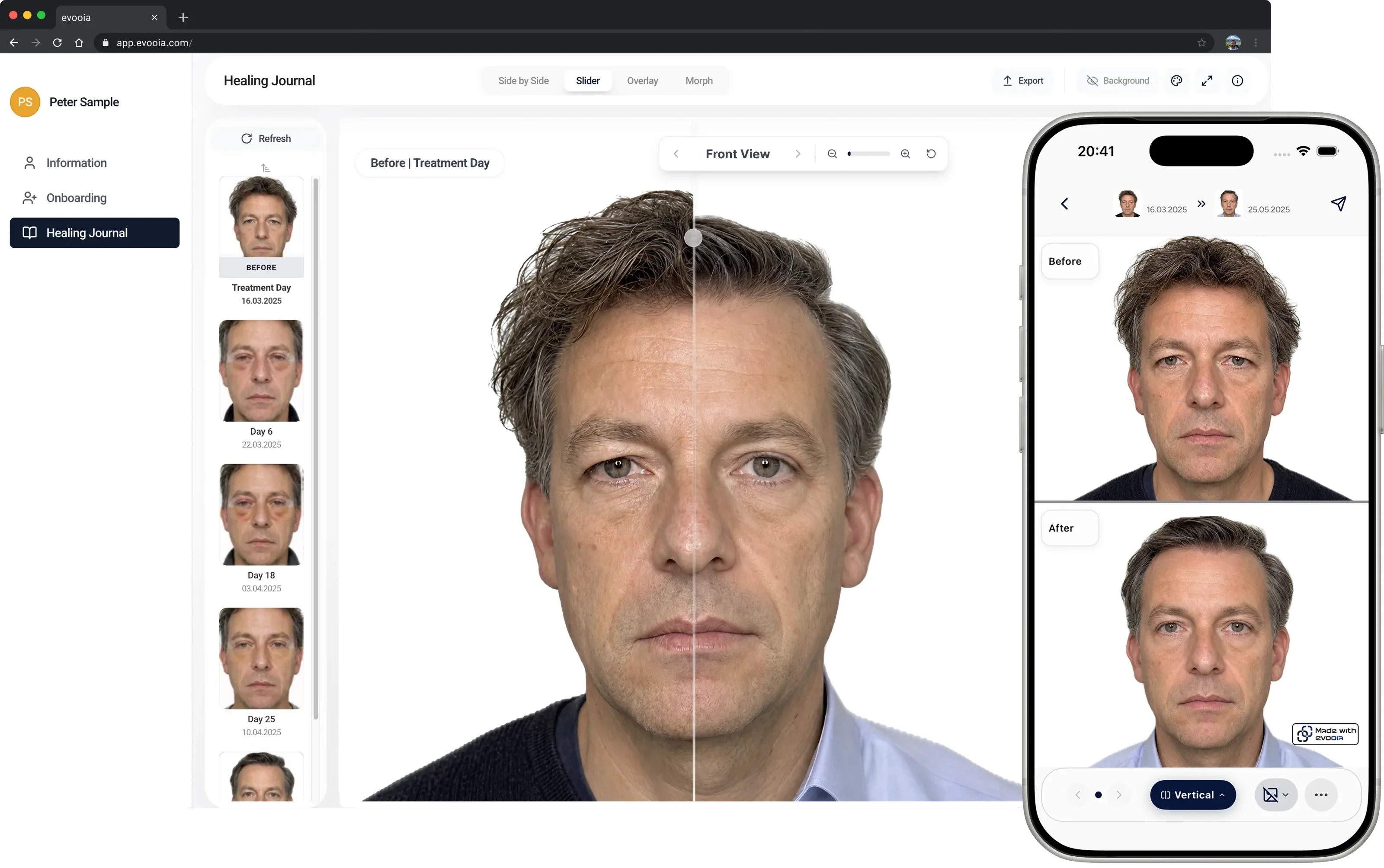 evooia web dashboard and mobile app: before/after (Eyes)