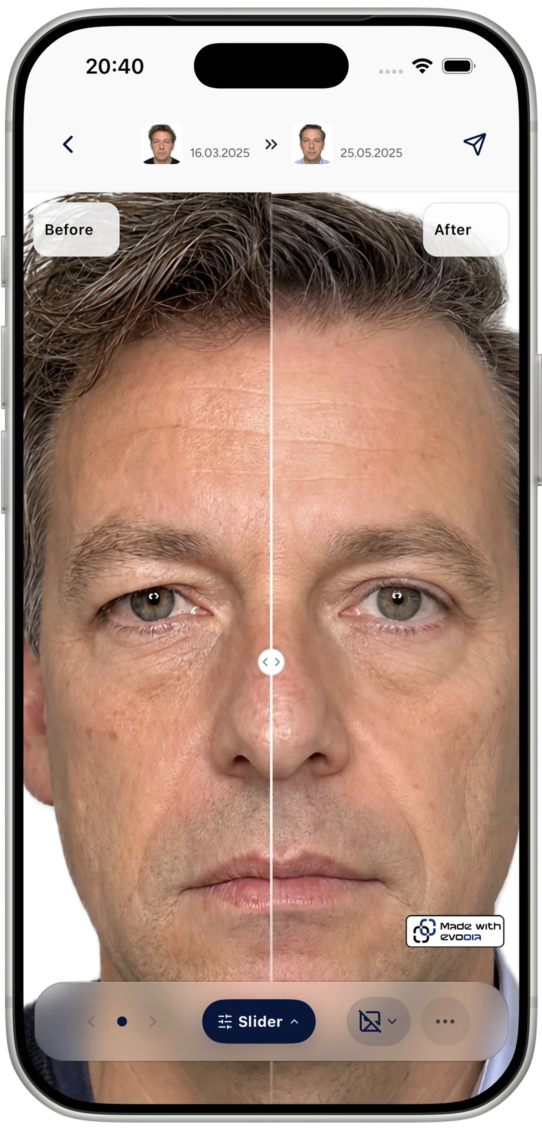 Patient app slider preview